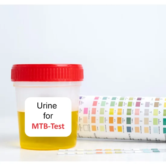 Urine TB PCR Test
